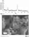 Fig. 02 - Zeolite, process for making same, and use thereof in converting aromatic hydrocarbons
