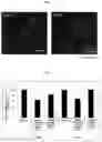 Fig. 02 - HYDRAZIDE COMPOUND AND KINASE INHIBITOR