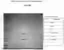 Fig. 07 - ANIMAL PRODUCT FREE SYSTEM AND PROCESS FOR PURIFYING A BOTULINUM TOXIN