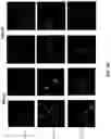 Fig. 17 - CHIMERIC TIM-3 FUSION PROTEIN