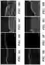 Fig. 11 - METHODS AND COMPOSITIONS FOR PROTEIN DELIVERY