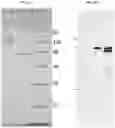 Fig. 03 - DENGUE VIRUS NON-STRUCTURAL PROTEIN 1 SPECIFIC BINDING POLYPEPTIDES AND METHODS OF USING THE SAME
