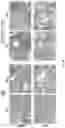 Fig. 10 - IDENTIFICATION AND TARGETING OF PATHOGENIC EXTRACELLULAR MATRIX FOR DIAGNOSIS AND TREATMENT OF CANCER AND OTHER DISEASES
