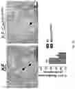 Fig. 12 - IDENTIFICATION AND TARGETING OF PATHOGENIC EXTRACELLULAR MATRIX FOR DIAGNOSIS AND TREATMENT OF CANCER AND OTHER DISEASES