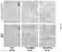 Fig. 14 - IDENTIFICATION AND TARGETING OF PATHOGENIC EXTRACELLULAR MATRIX FOR DIAGNOSIS AND TREATMENT OF CANCER AND OTHER DISEASES