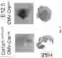 Fig. 46 - IDENTIFICATION AND TARGETING OF PATHOGENIC EXTRACELLULAR MATRIX FOR DIAGNOSIS AND TREATMENT OF CANCER AND OTHER DISEASES