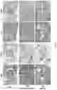 Fig. 48 - IDENTIFICATION AND TARGETING OF PATHOGENIC EXTRACELLULAR MATRIX FOR DIAGNOSIS AND TREATMENT OF CANCER AND OTHER DISEASES