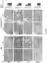 Fig. 54 - IDENTIFICATION AND TARGETING OF PATHOGENIC EXTRACELLULAR MATRIX FOR DIAGNOSIS AND TREATMENT OF CANCER AND OTHER DISEASES