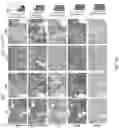 Fig. 56 - IDENTIFICATION AND TARGETING OF PATHOGENIC EXTRACELLULAR MATRIX FOR DIAGNOSIS AND TREATMENT OF CANCER AND OTHER DISEASES