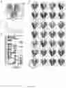 Fig. 07 - LILRB4-binding antibody and methods of use thereof