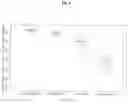 Fig. 05 - Methods of treating systemic lupus erythematosus using a domain antibody directed against CD28