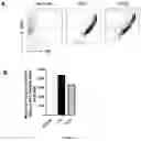 Fig. 02 - NOVEL ANTI-IFNAR1 ANTIBODIES