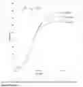 Fig. 08 - AMINE COMPOSITION USEFUL FOR MAKING STABLE POLYURETHANE FOAM SYSTEMS