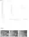 Fig. 11 - THERMOPLASTIC RESIN, METHOD FOR MANUFACTURING SAME, AND OPTICAL LENS