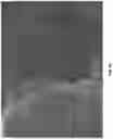 Fig. 08 - IMPROVEMENTS RELATING TO SUPERHYDROPHOBIC SURFACES