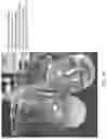 Fig. 11 - Treating fluid comprising hydrocarbons, water, and polymer