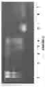 Fig. 06 - Carbo-ionic cultures and extracts and applications thereof