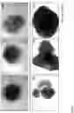 Fig. 03 - GENERATION OF HUMAN PLURIPOTENT STEM CELL DERIVED ARTIFICIAL TISSUE STRUCTURES WITHOUT THREE DIMENSIONAL MATRICES