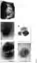 Fig. 07 - GENERATION OF HUMAN PLURIPOTENT STEM CELL DERIVED ARTIFICIAL TISSUE STRUCTURES WITHOUT THREE DIMENSIONAL MATRICES