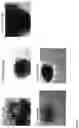 Fig. 08 - GENERATION OF HUMAN PLURIPOTENT STEM CELL DERIVED ARTIFICIAL TISSUE STRUCTURES WITHOUT THREE DIMENSIONAL MATRICES