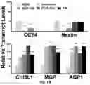 Fig. 03 - Use of Adipose-Derived Stem Cells for Glaucoma Treatment