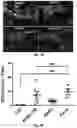 Fig. 12 - Use of Adipose-Derived Stem Cells for Glaucoma Treatment