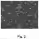 Fig. 04 - IMMUNOMODULATION BY AMNIOTIC FLUID MESENCHYMAL STEM CELLS