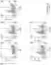 Fig. 48 - GENETICALLY-MODIFIED CELLS COMPRISING A MODIFIED HUMAN T CELL RECEPTOR ALPHA CONSTANT REGION GENE