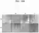 Fig. 21 - Osteoporosis model comprising calcium phosphate hydrogel composition and use thereof