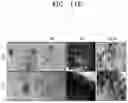 Fig. 23 - Osteoporosis model comprising calcium phosphate hydrogel composition and use thereof