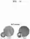 Fig. 27 - Osteoporosis model comprising calcium phosphate hydrogel composition and use thereof