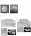 Fig. 13 - METHOD FOR PRODUCING OSTEOBLAST CLUSTER USING IPS CELLS