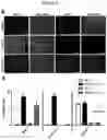 Fig. 04 - Methods for obtaining induced smooth muscle cells