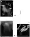 Fig. 03 - Liver Tissue Model Constructs and Methods for Providing the Same
