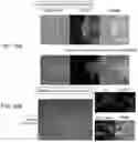 Fig. 11 - METHOD FOR CULTURING HEPATIC EPITHELIOID TISSUE HAVING A STRUCTURE OF CONNECTIONS BETWEEN HEPATOCYTES AND BILE DUCT EPITHELIAL CELL