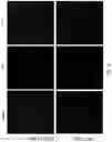 Fig. 15 - Methods relating to intestinal organ-on-a-chip