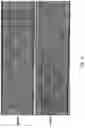Fig. 16 - Methods relating to intestinal organ-on-a-chip