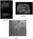 Fig. 26 - Methods relating to intestinal organ-on-a-chip