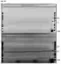 Fig. 04 - Purification Process for Biological Molecules Such as Plasmid DNA Using Anionic Exchange Chromatography