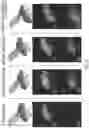 Fig. 14 - RNA-TARGETING CAS ENZYMES