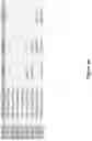 Fig. 18 - Altering Gene Expression in Modified T Cells and Uses Thereof