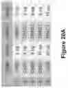 Fig. 62 - Altering Gene Expression in Modified T Cells and Uses Thereof