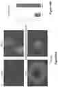 Fig. 92 - Altering Gene Expression in Modified T Cells and Uses Thereof