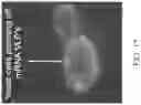 Fig. 18 - Yeast-Based Oral Vaccination
