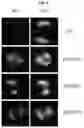 Fig. 20 - Targeting Nuclear-Encoded Recombinant Proteins to the Chloroplast in Microalgae