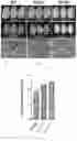 Fig. 03 - Polypeptide and nucleic acid capable of changing amylose content (ac) in plant, and use thereof