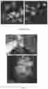 Fig. 04 - CANCER IMMUNOTHERAPY