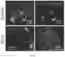 Fig. 18 - CANCER IMMUNOTHERAPY