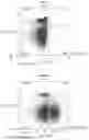 Fig. 33 - IMPROVED PROCESS FOR INTEGRATION OF DNA CONSTRUCTS USING RNA-GUIDED ENDONUCLEASES