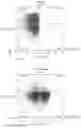 Fig. 36 - IMPROVED PROCESS FOR INTEGRATION OF DNA CONSTRUCTS USING RNA-GUIDED ENDONUCLEASES